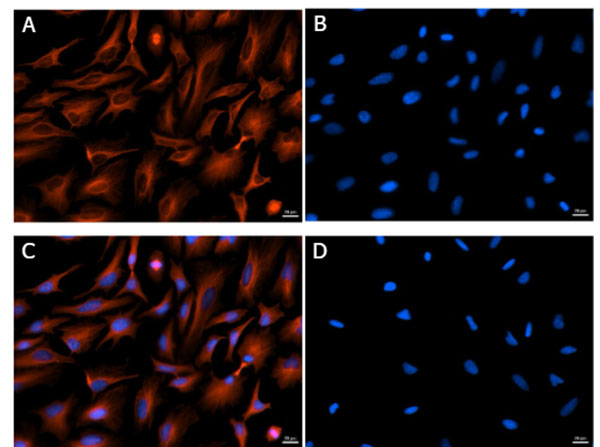 Immunofluorescence of Rabbit Anti-Mouse IgG Texas Red